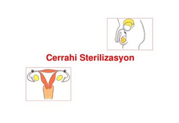 Cerrahi Sterilizasyon