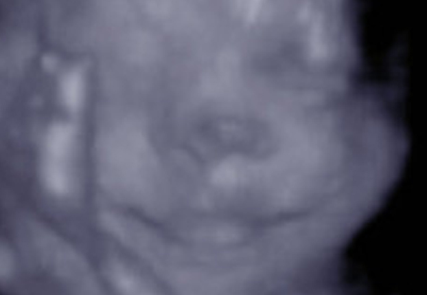 18. Hafta - Bebeğiniz bu hafta, kapı çarpması, fren sesi gibi şiddetli seslere tepki verecektir.